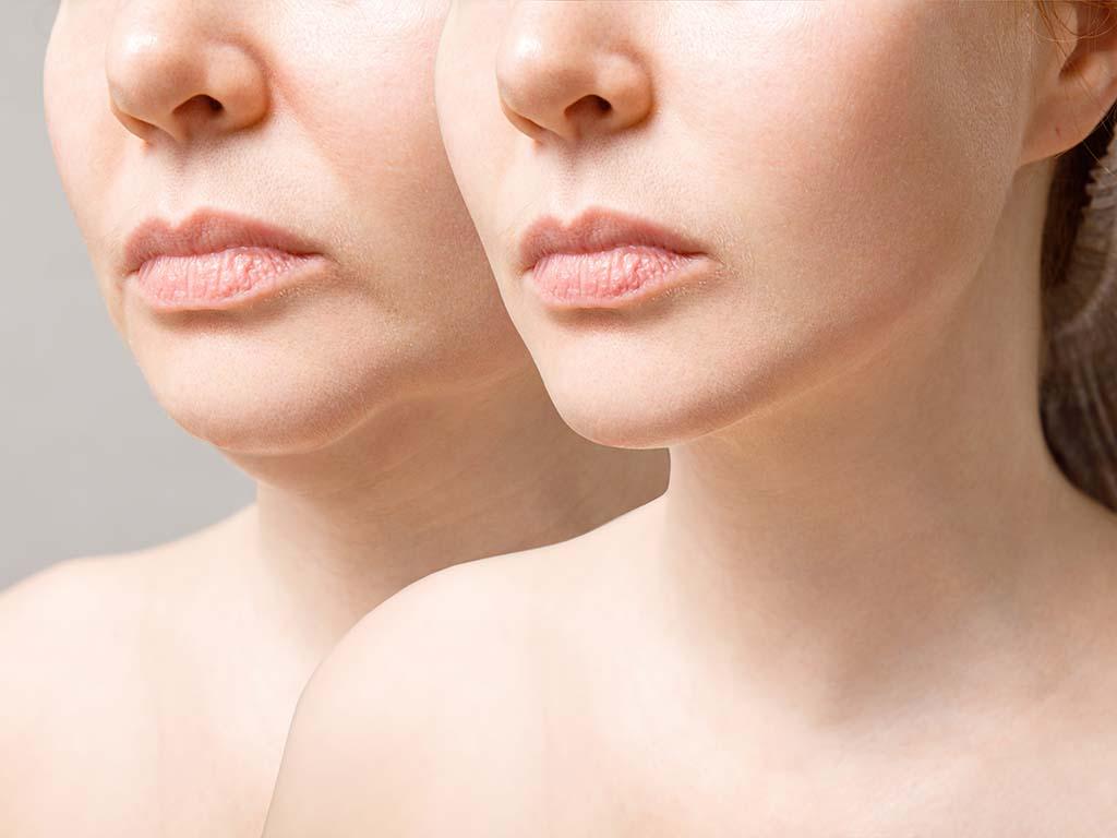 Understanding The Risks And Rewards Of Plastic Surgery